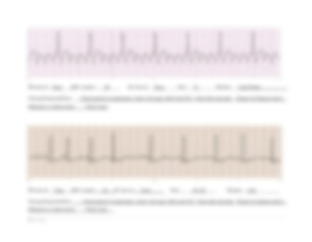 ECG Strip Student Practice key.docx_d9wuw1h1ye5_page4