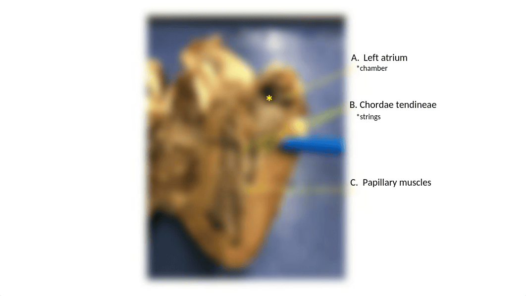 Heart & EKG Assignment.pptx_d9xtm0ew8jj_page5