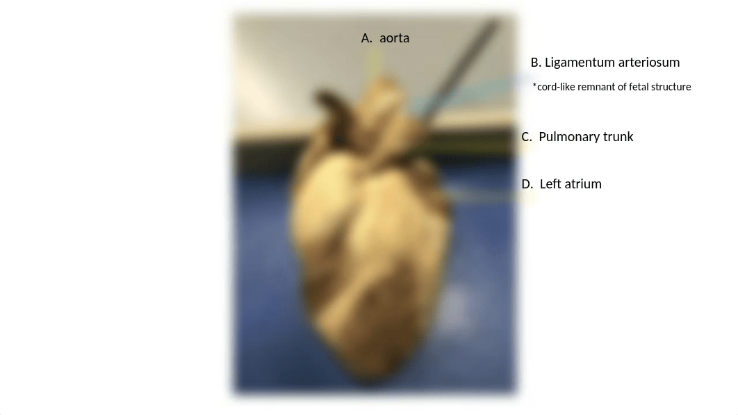 Heart & EKG Assignment.pptx_d9xtm0ew8jj_page3