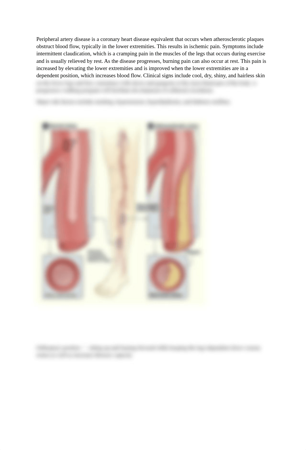 Study guide exam 3 Perfusion and Clotting SP21.docx_d9y7mzwymtp_page2