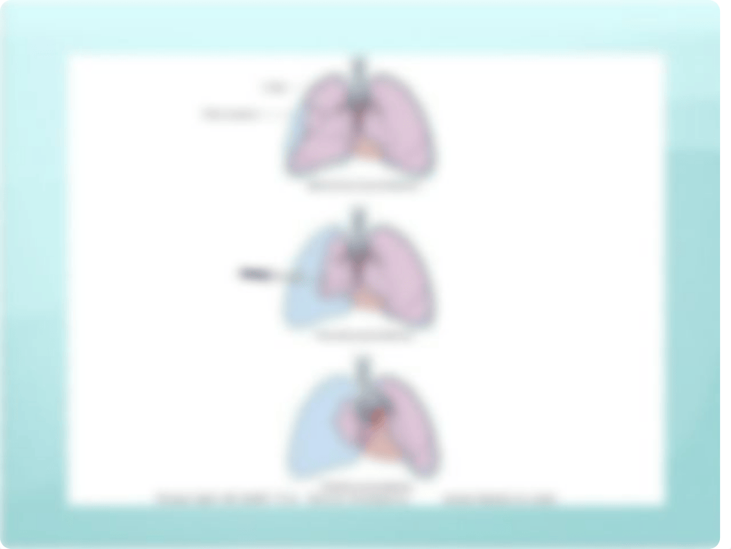 Chest Tube PPP lecture, B & L, W & H_da15q2g6ogu_page4