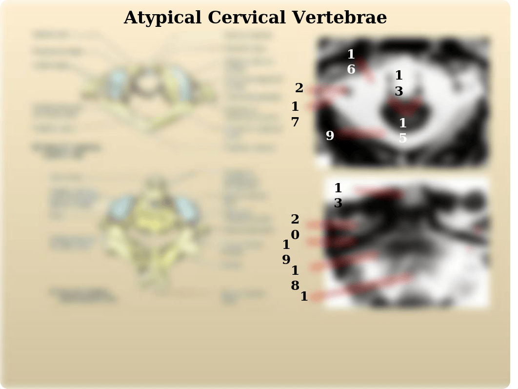 Radiological Anatomy of Back I.ppt_da3ly9mkqzk_page2