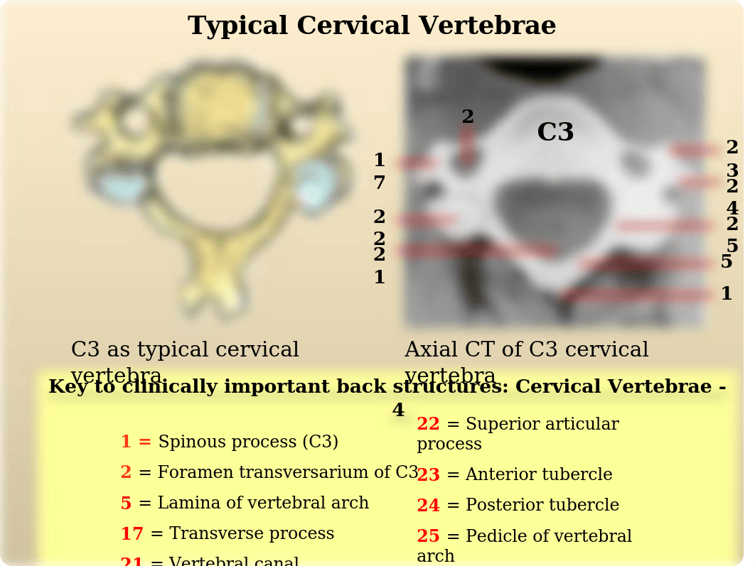 Radiological Anatomy of Back I.ppt_da3ly9mkqzk_page5