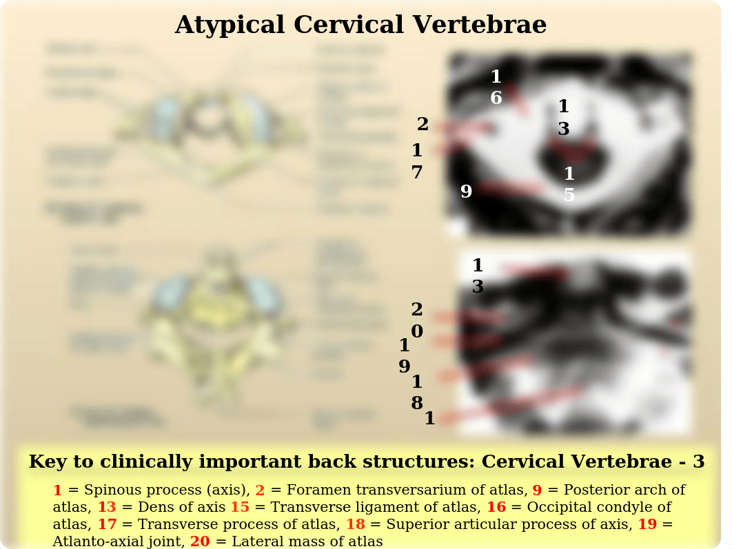 Radiological Anatomy of Back I.ppt_da3ly9mkqzk_page3