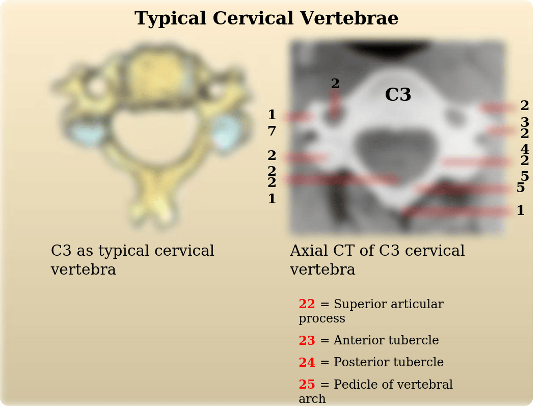 Radiological Anatomy of Back I.ppt_da3ly9mkqzk_page4