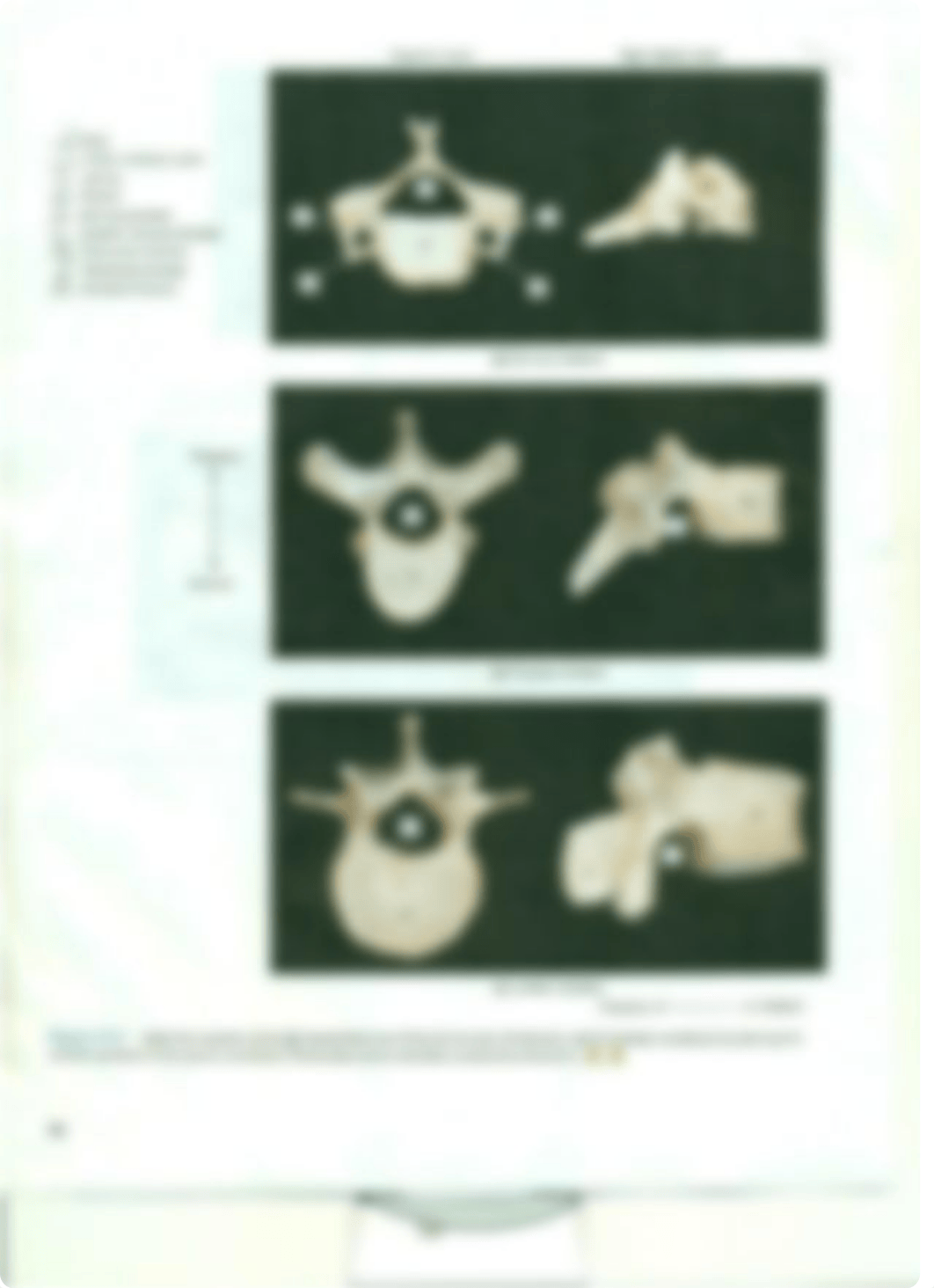 Chapter 10 Vertebral Column and Thoracic Cage_da4lsfilxv1_page4