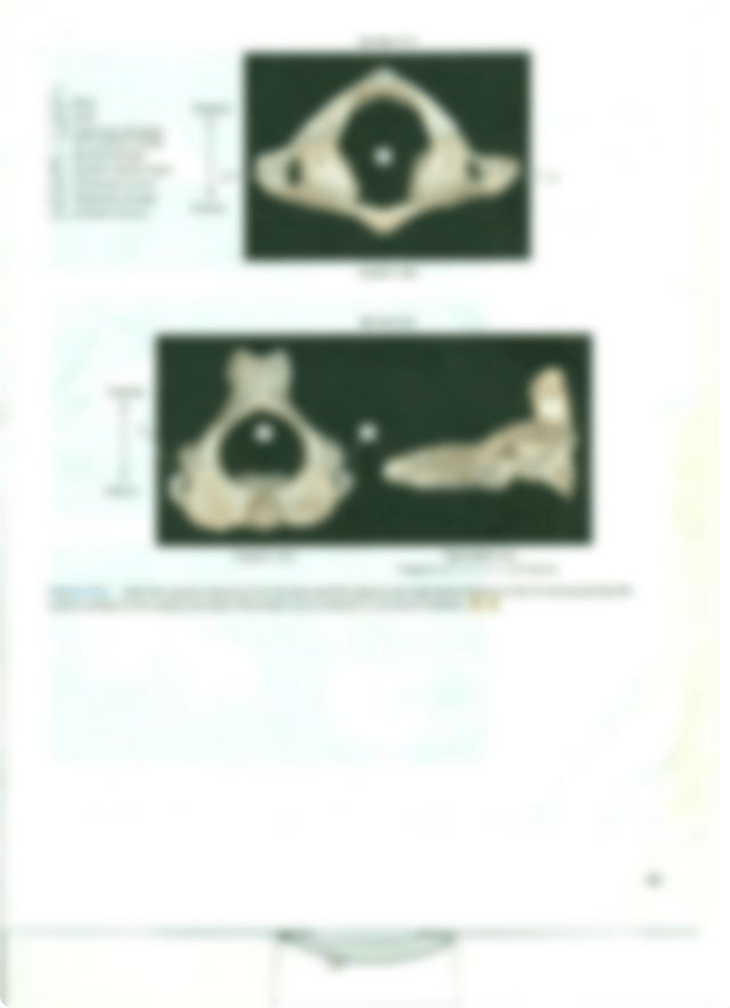 Chapter 10 Vertebral Column and Thoracic Cage_da4lsfilxv1_page3