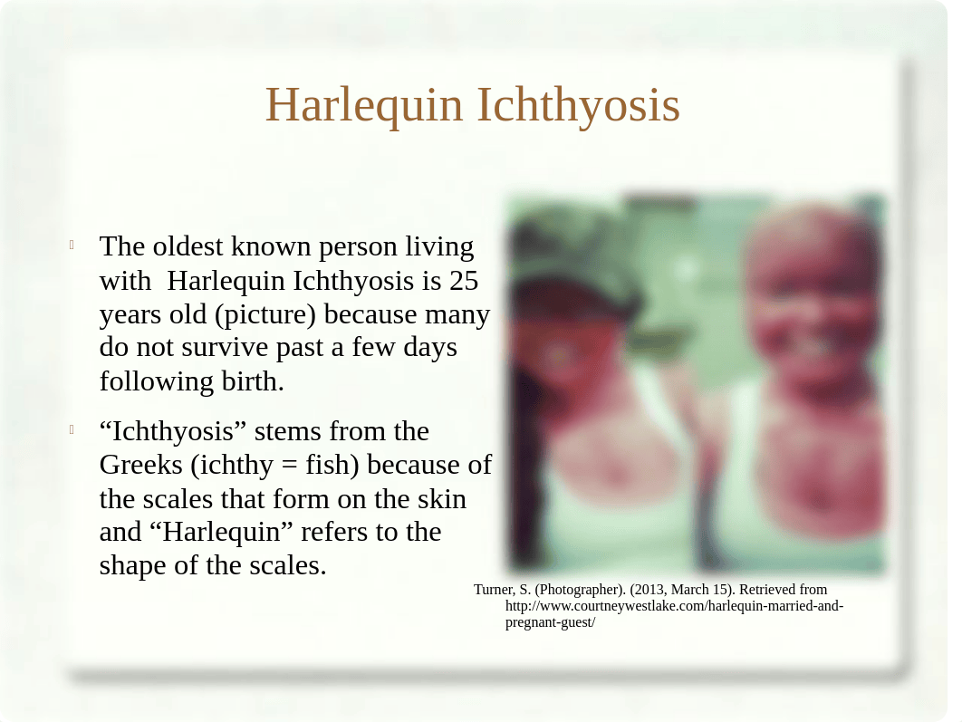 Harlequin Ichthyosis.ppt_da6jo33b06y_page2