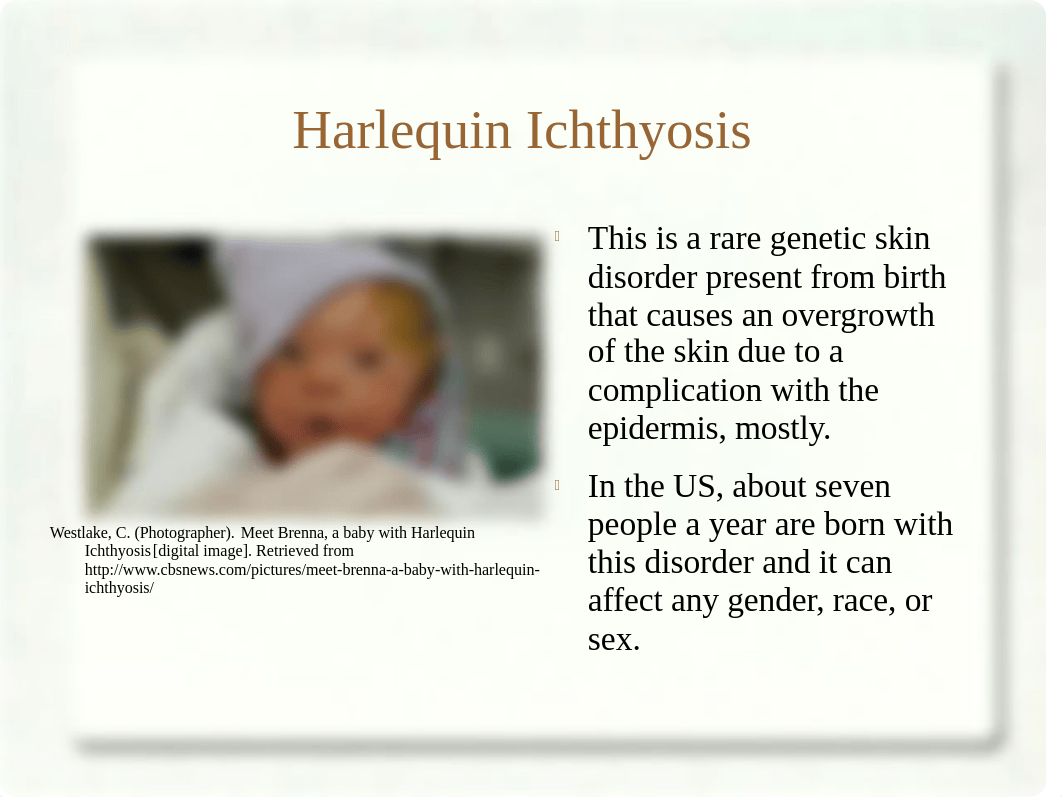 Harlequin Ichthyosis.ppt_da6jo33b06y_page1