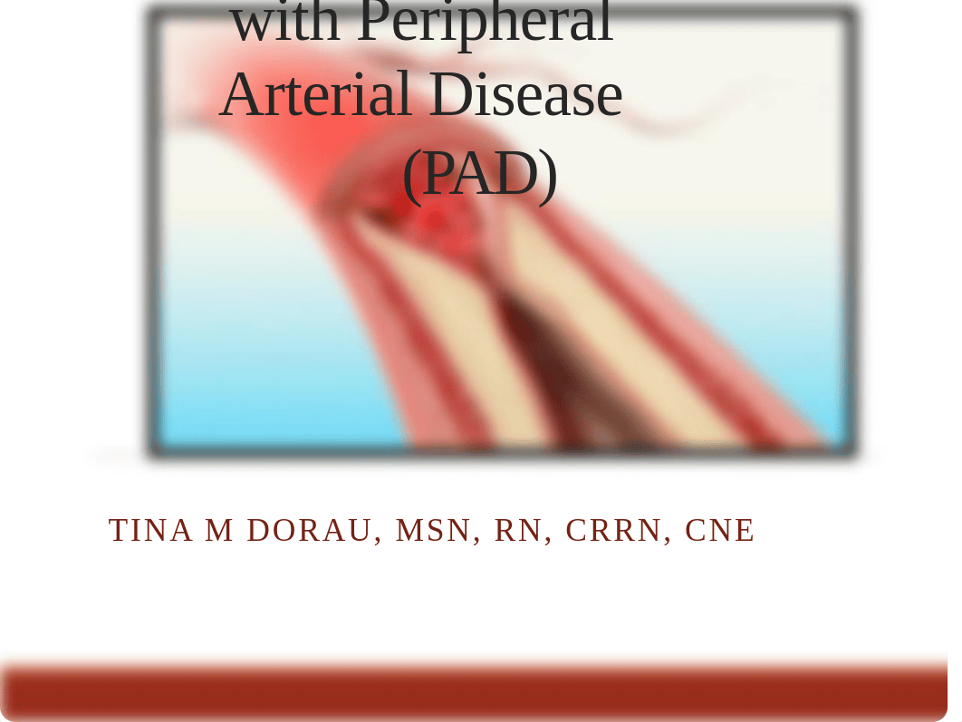 Peripheral Arterial Disease Powerpoint_dae7pjkl8uk_page1