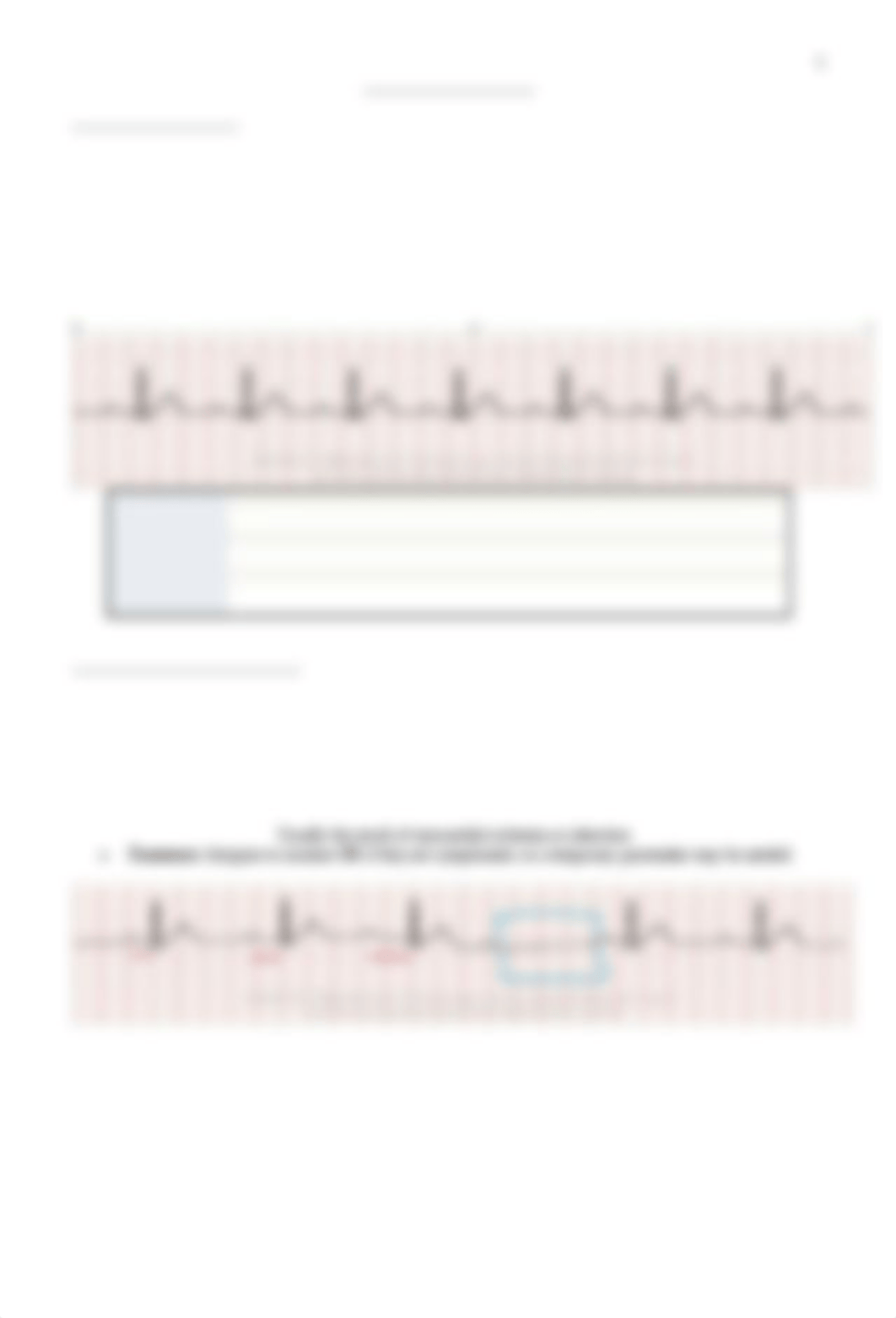 Heart Blocks Exam 2.docx_dafwksd7y07_page1