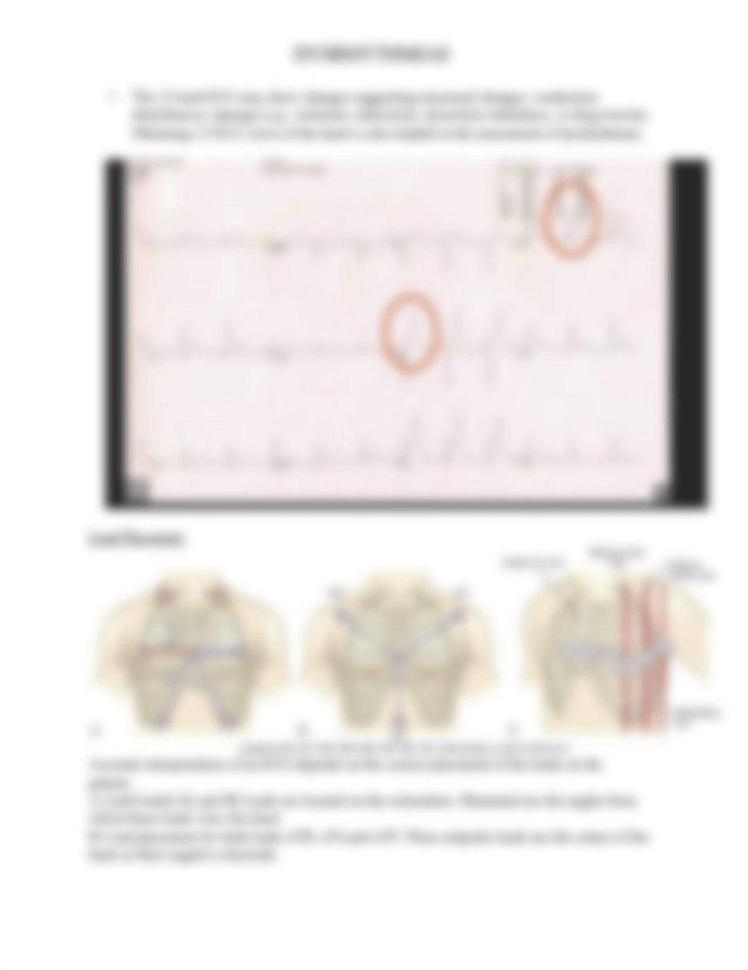 DYSRHYTHMIAS Notes (1).docx_dag39hg0mhz_page5