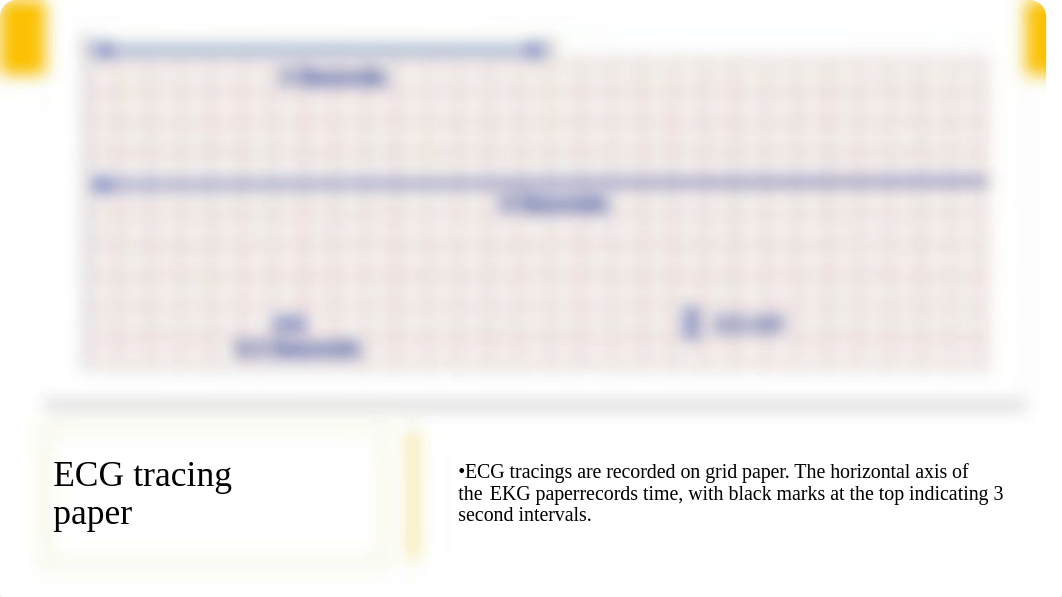 ECG Interpretation. Practical session. Questions.pptx_dajxned6qnj_page3