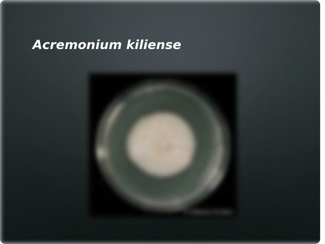 4 Bacterial Yeast and Fungal Colonies.pptx_daq2cw1cbgj_page4