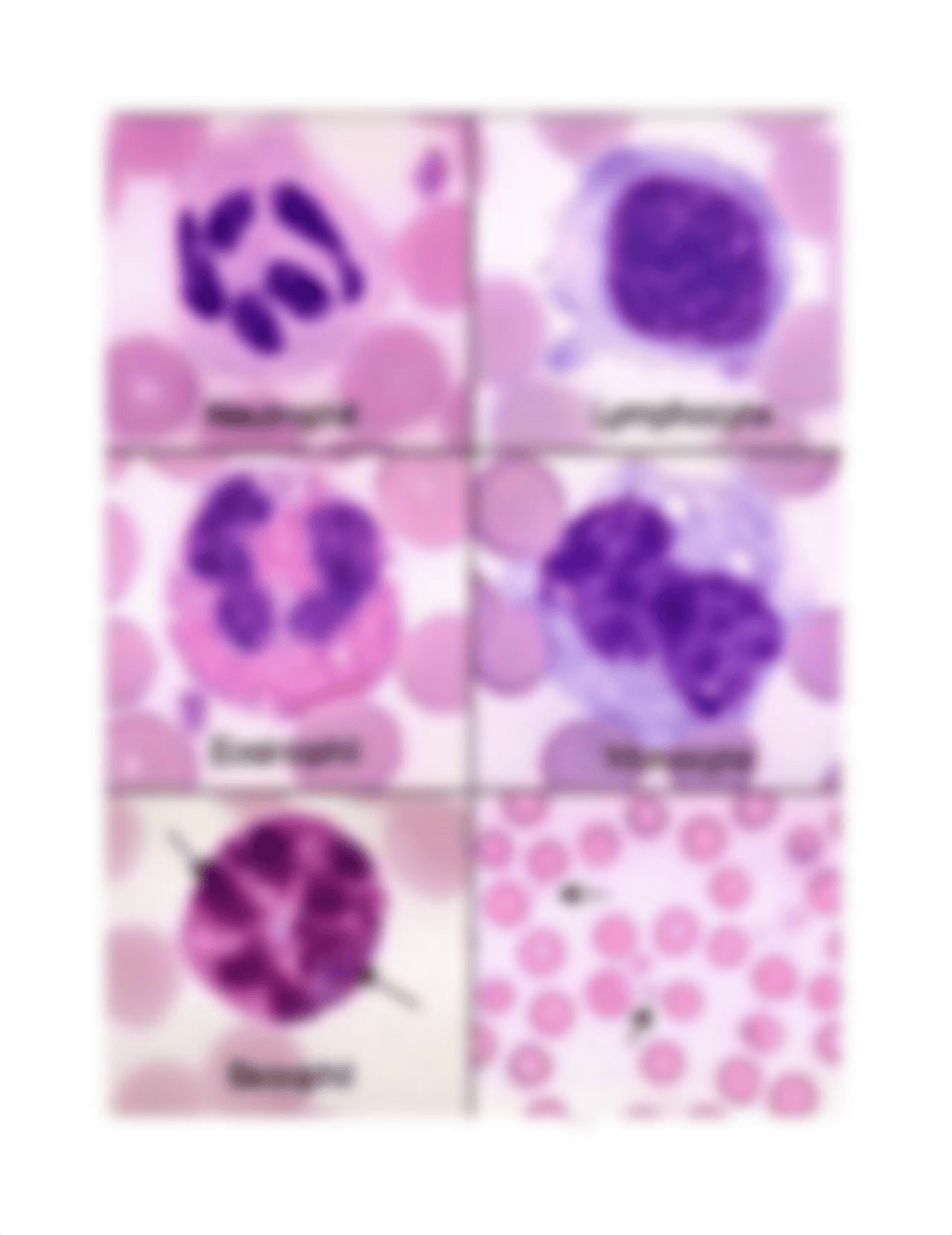 1. JOHNSON_NEOPLASTIC WBC DISORDERS STUDYSHEET.pdf_dauultsil03_page1