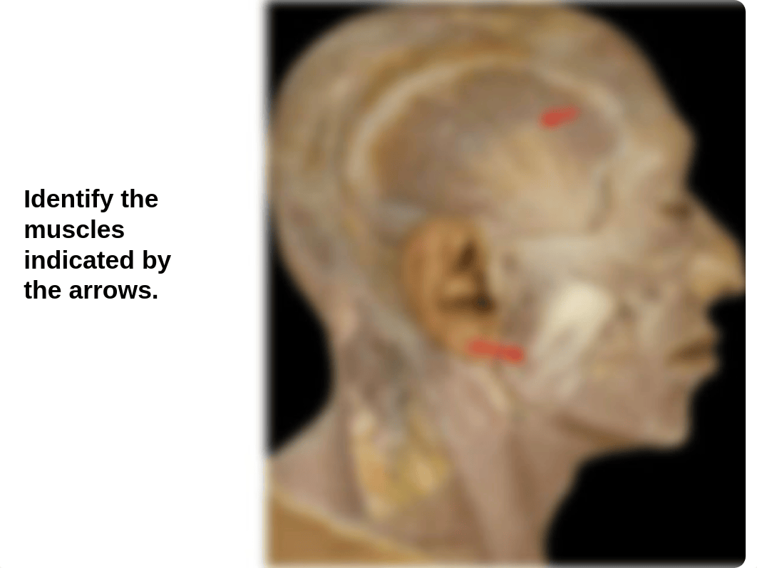 Lab_Temporal Infratemporal Pterygopalatine_daztkjqroeb_page4