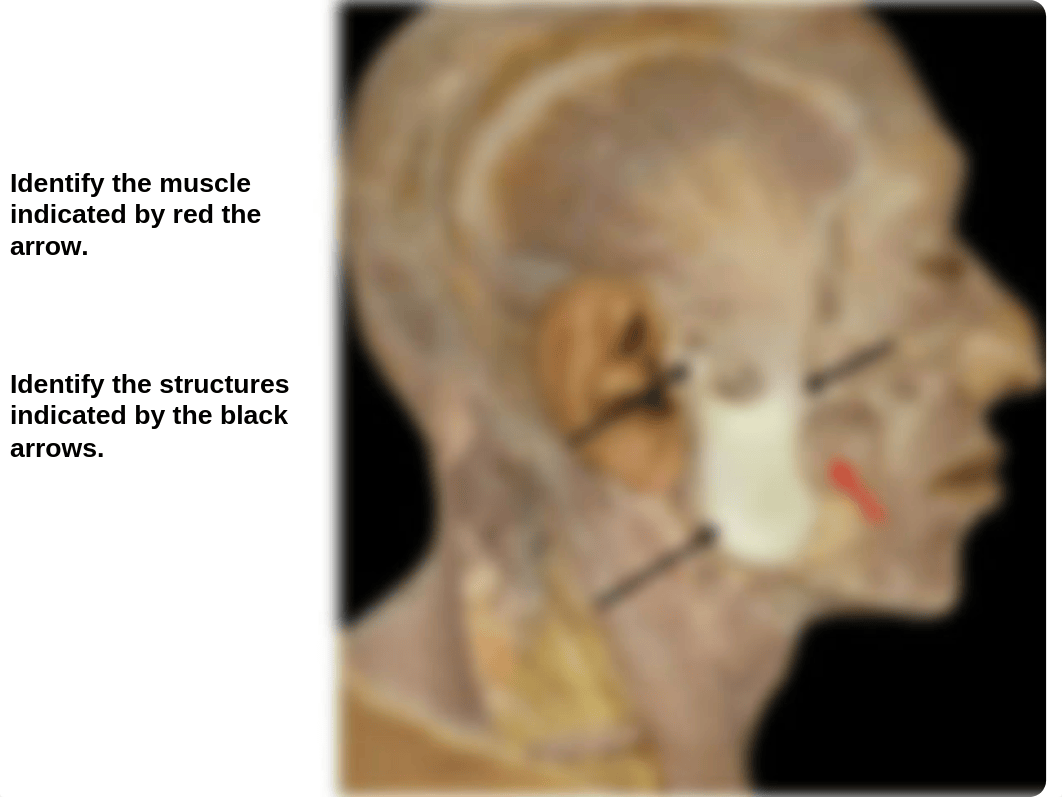 Lab_Temporal Infratemporal Pterygopalatine_daztkjqroeb_page5