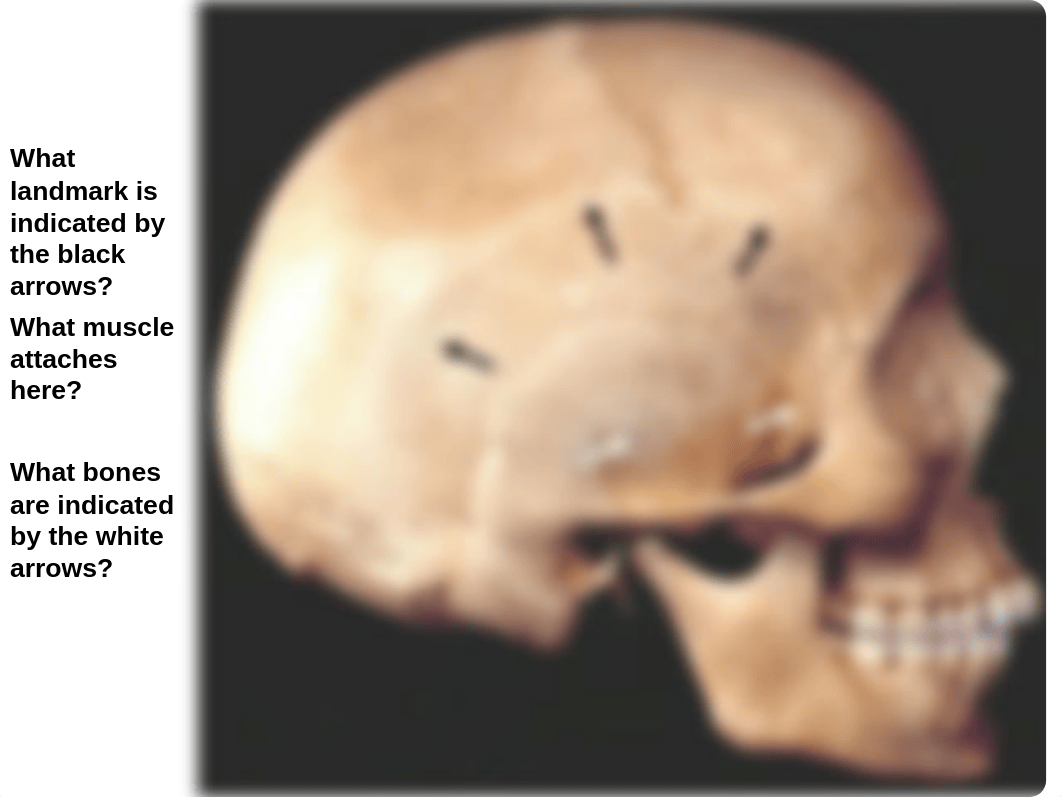 Lab_Temporal Infratemporal Pterygopalatine_daztkjqroeb_page3