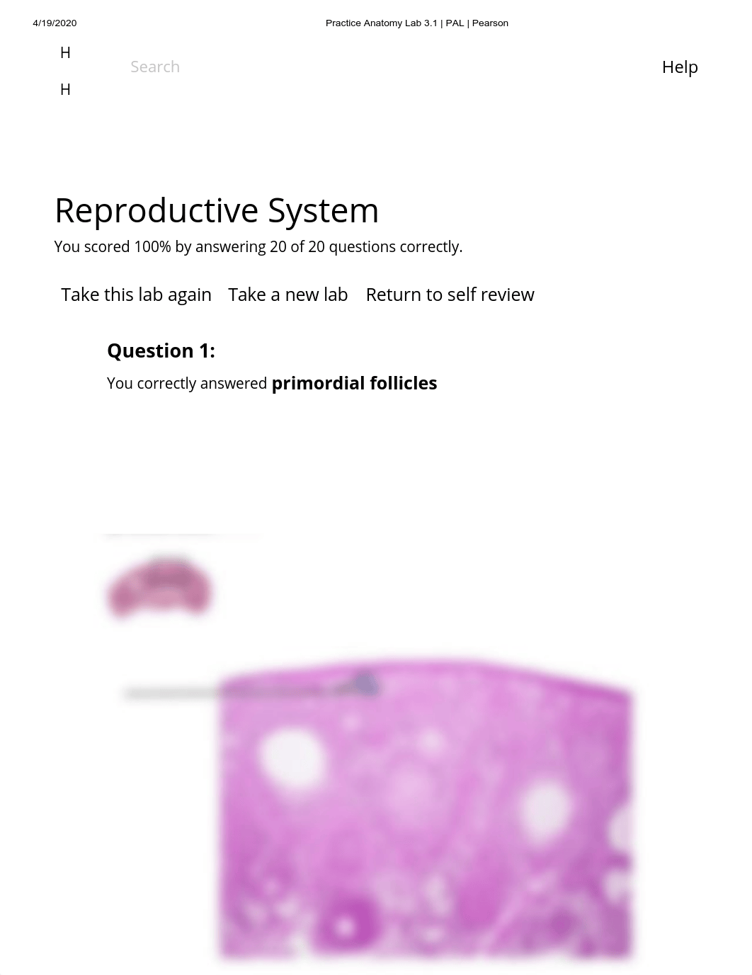 Doris Bowdre  Histology  Reproductive System Lab Practical.pdf_db0fobw6471_page1