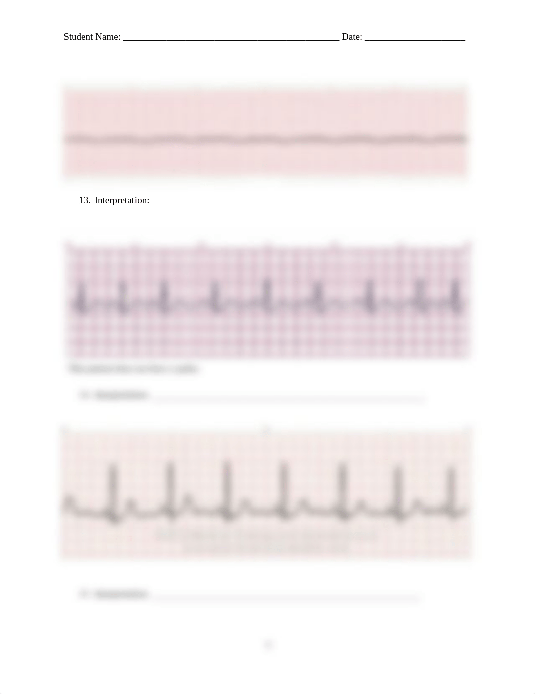 410_ECG Interpretation Quiz 2.docx_db6ttl72y2v_page5