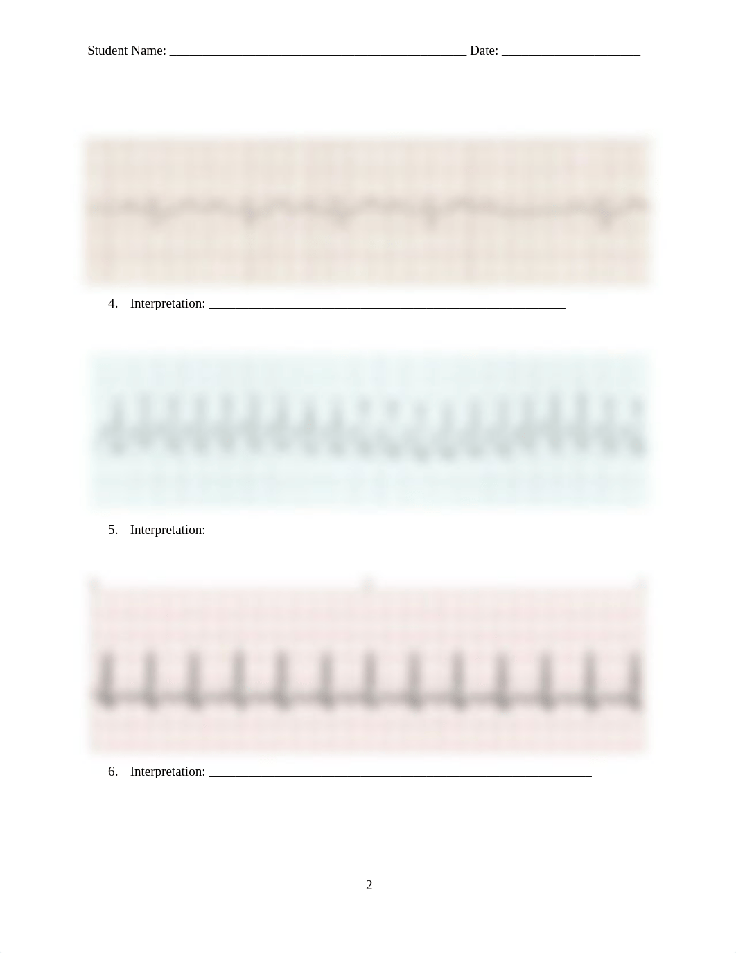 410_ECG Interpretation Quiz 2.docx_db6ttl72y2v_page2