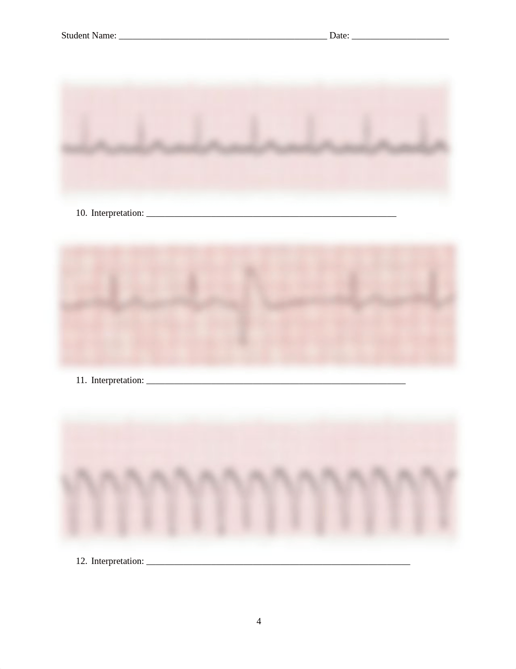 410_ECG Interpretation Quiz 2.docx_db6ttl72y2v_page4