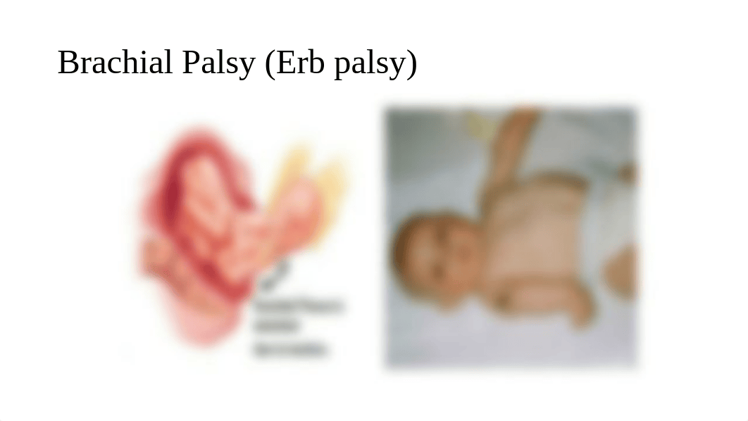 Chapter 25 OB The High Risk Newborn (1).pptx_db8cnb4gfyr_page4