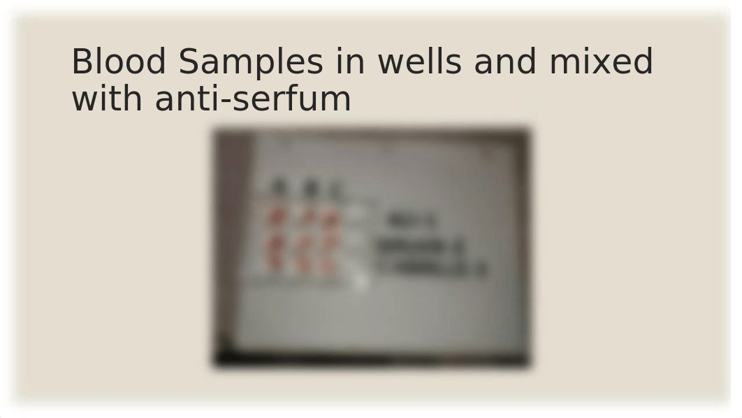 Lab 10 Blood and heart, Blood Typing Experiment..pptx_dbaekf6jpvp_page5