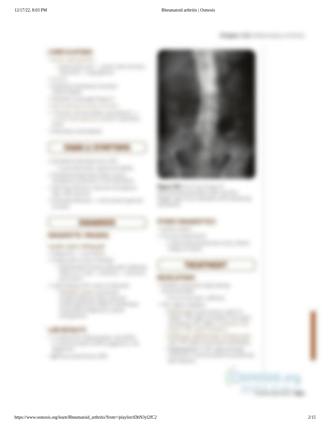 Rheumatoid arthritis _ Osmosis.pdf_dbboz33r3lc_page2