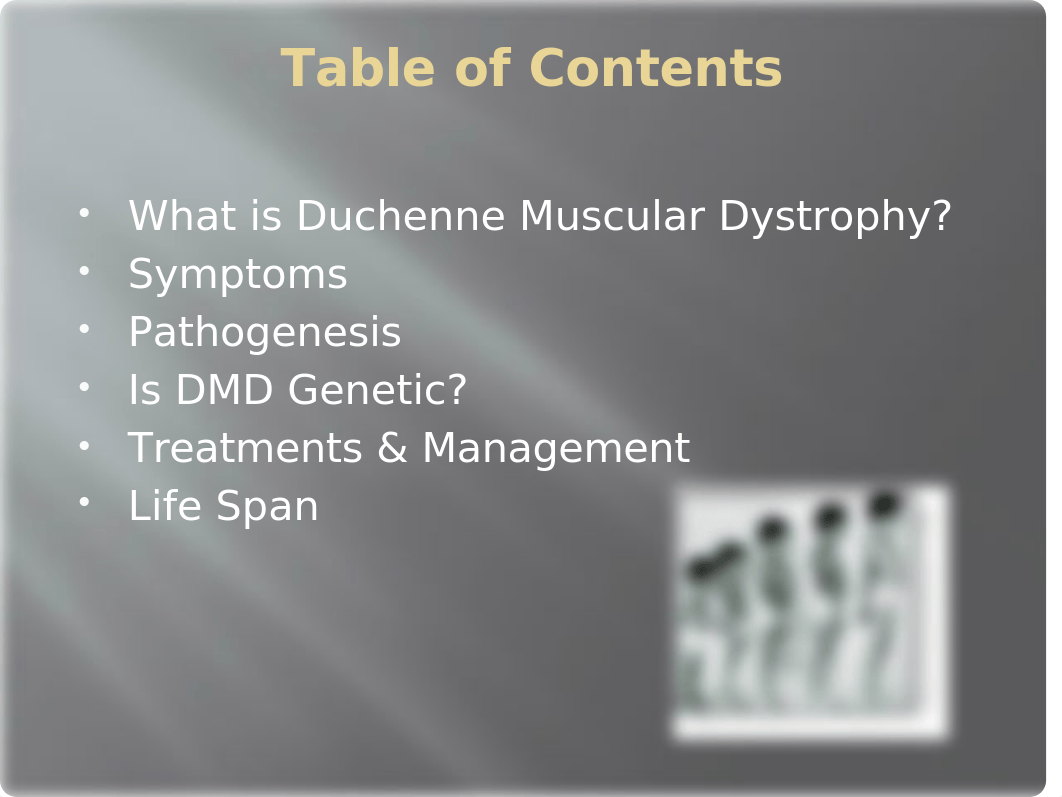 Duchenne Muscular Dystrophy.pptx_dbgv32nhjvv_page2