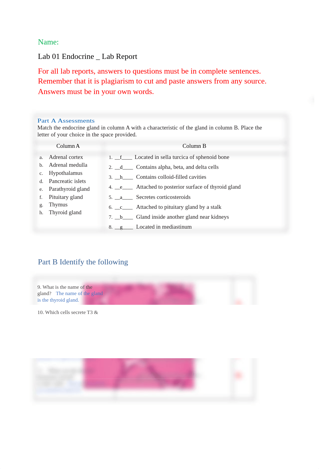 Endocrine Lab Report Submission.doc_dbr81e1cxxg_page1