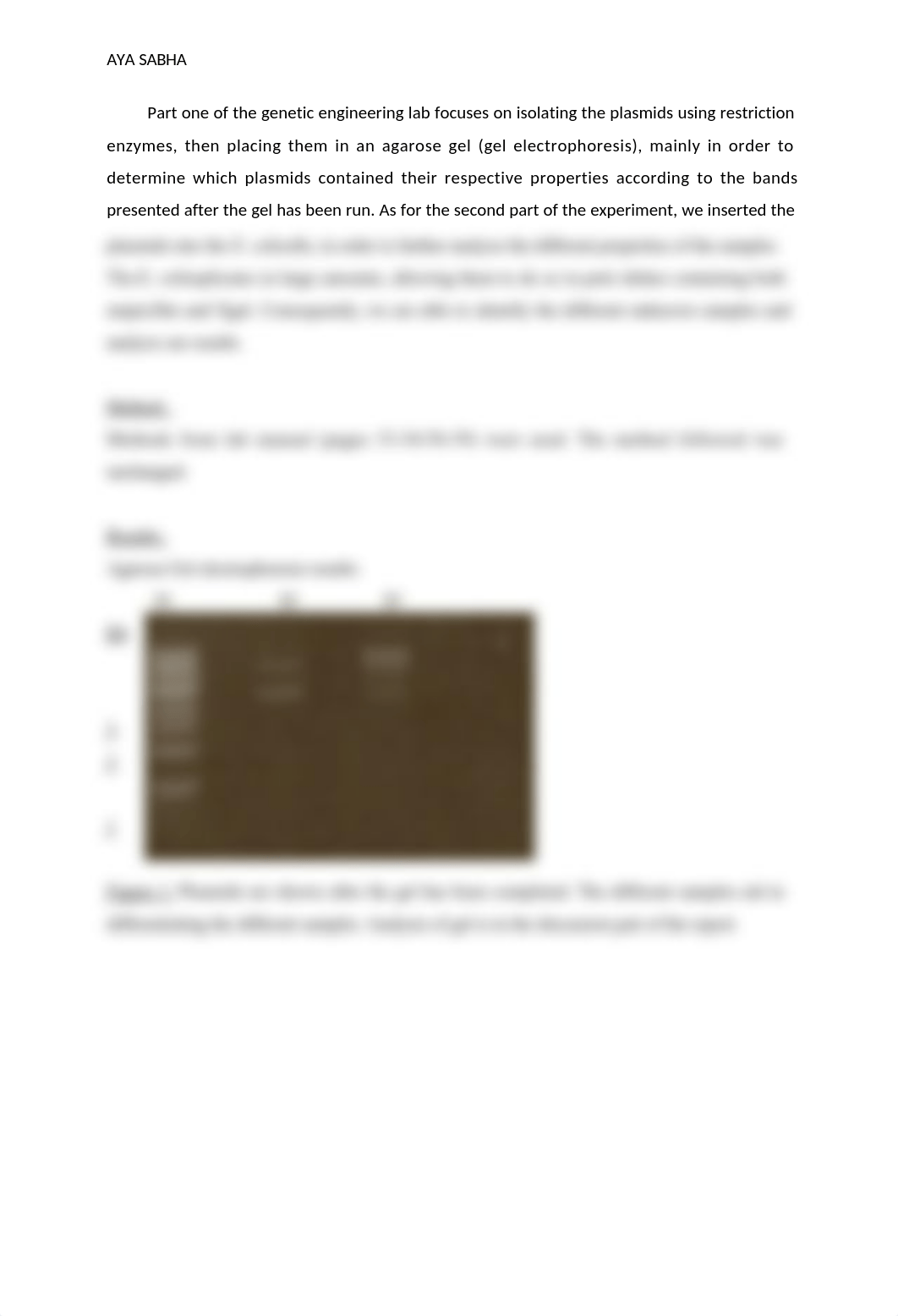 Agarose gel electrophoresis .docx_dbvols626fu_page2