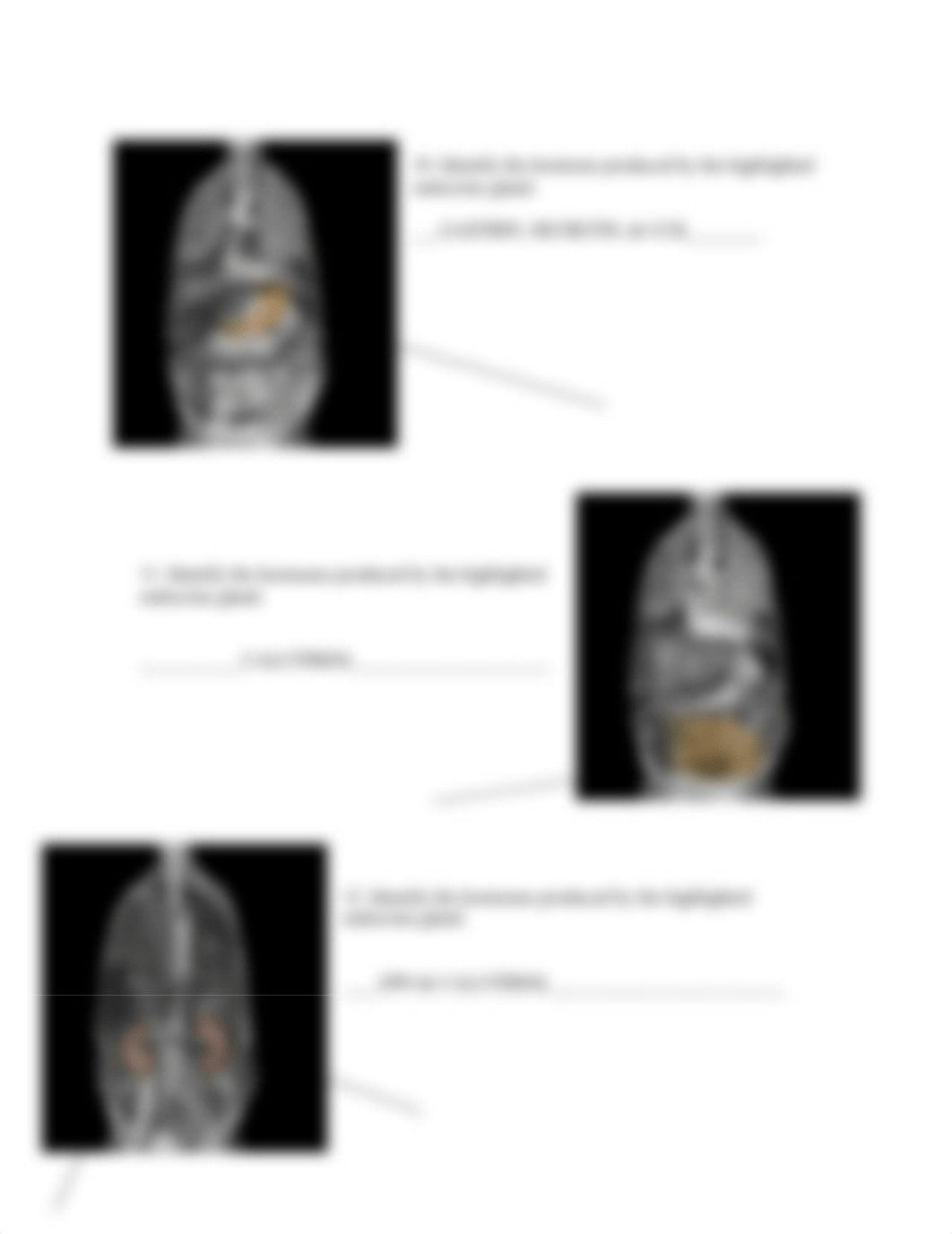 real anatomy endo_prod_sites_stud .doc_dbwwa39gust_page5