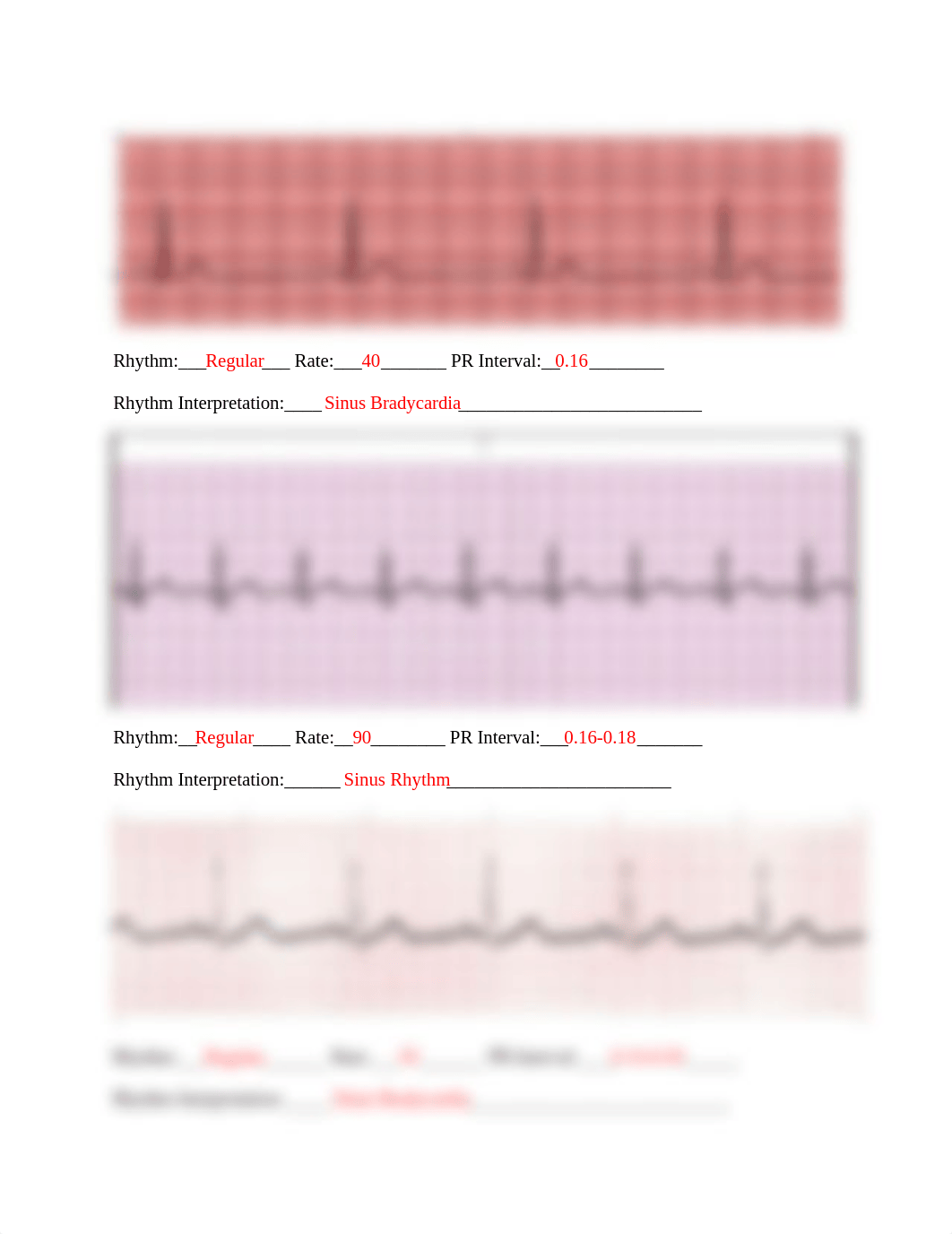 EKG Practice Strip Assignment- Instructor KEY(1).docx_dbztvu0maym_page2