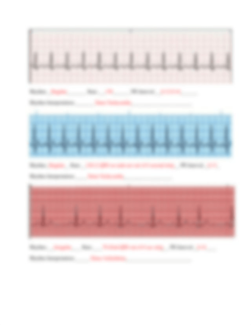 EKG Practice Strip Assignment- Instructor KEY(1).docx_dbztvu0maym_page3