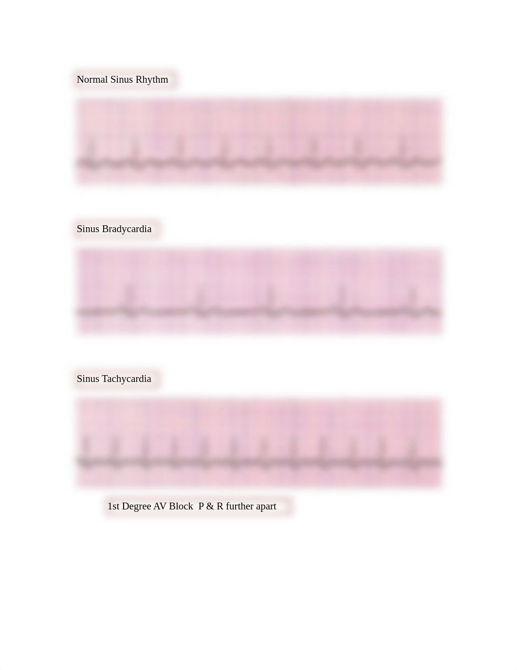 ecgstrips_dc1jswn95v0_page1