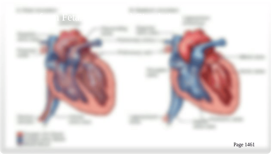 Ch. 41 Nursing Care of the Child with alteration in perfusion (1).pptx_dc218myokim_page5