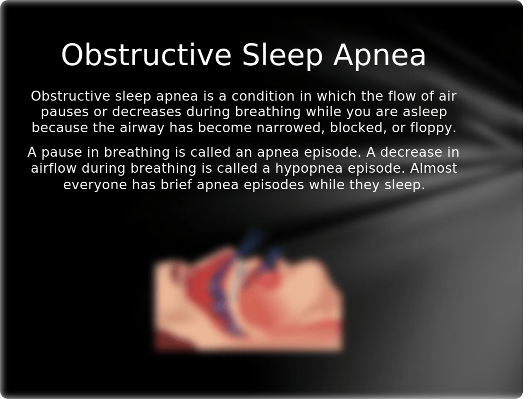 Camm PSY 200 sleep apnea presentation_dc5ufzkmfl0_page2