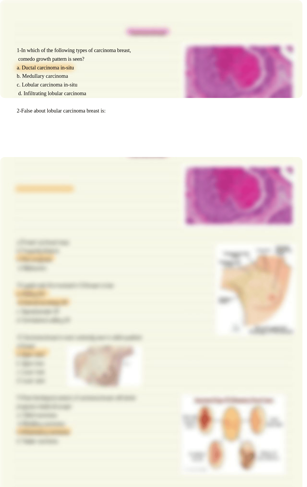 Breast Surgery Notes (Mcqs- Cases).pdf_dc75j5sgwfb_page4