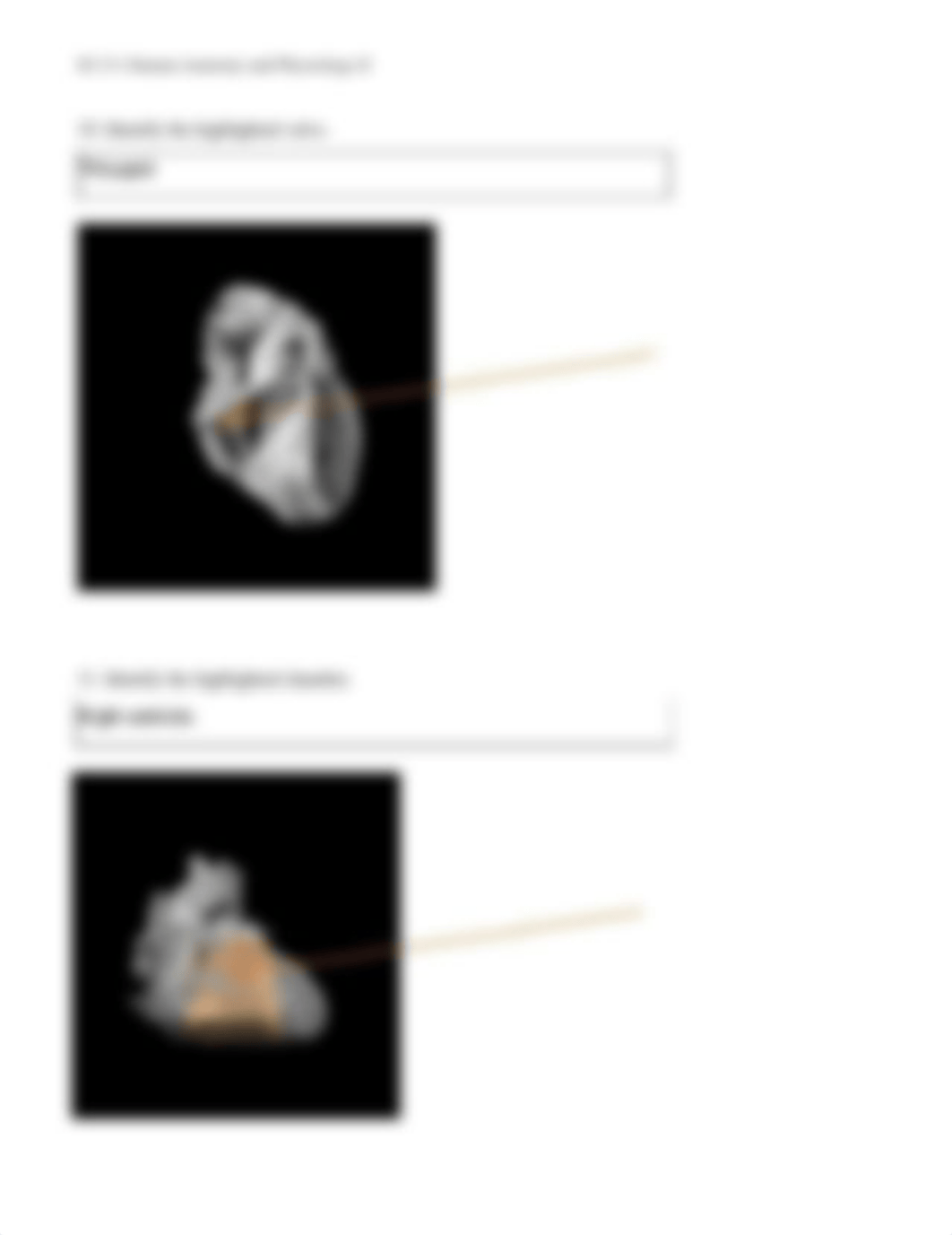 SC131 Unit 2 Assignment_ Lab Worksheet-Heart (2)ErinMauney (1)_dc9yxacc35p_page5