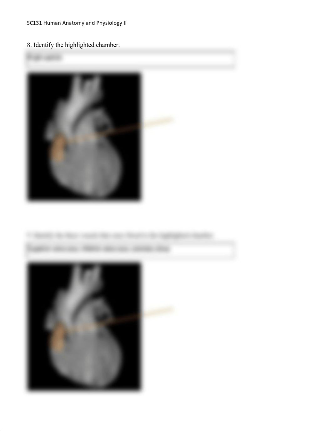 SC131 Unit 2 Assignment_ Lab Worksheet-Heart (2)ErinMauney (1)_dc9yxacc35p_page4