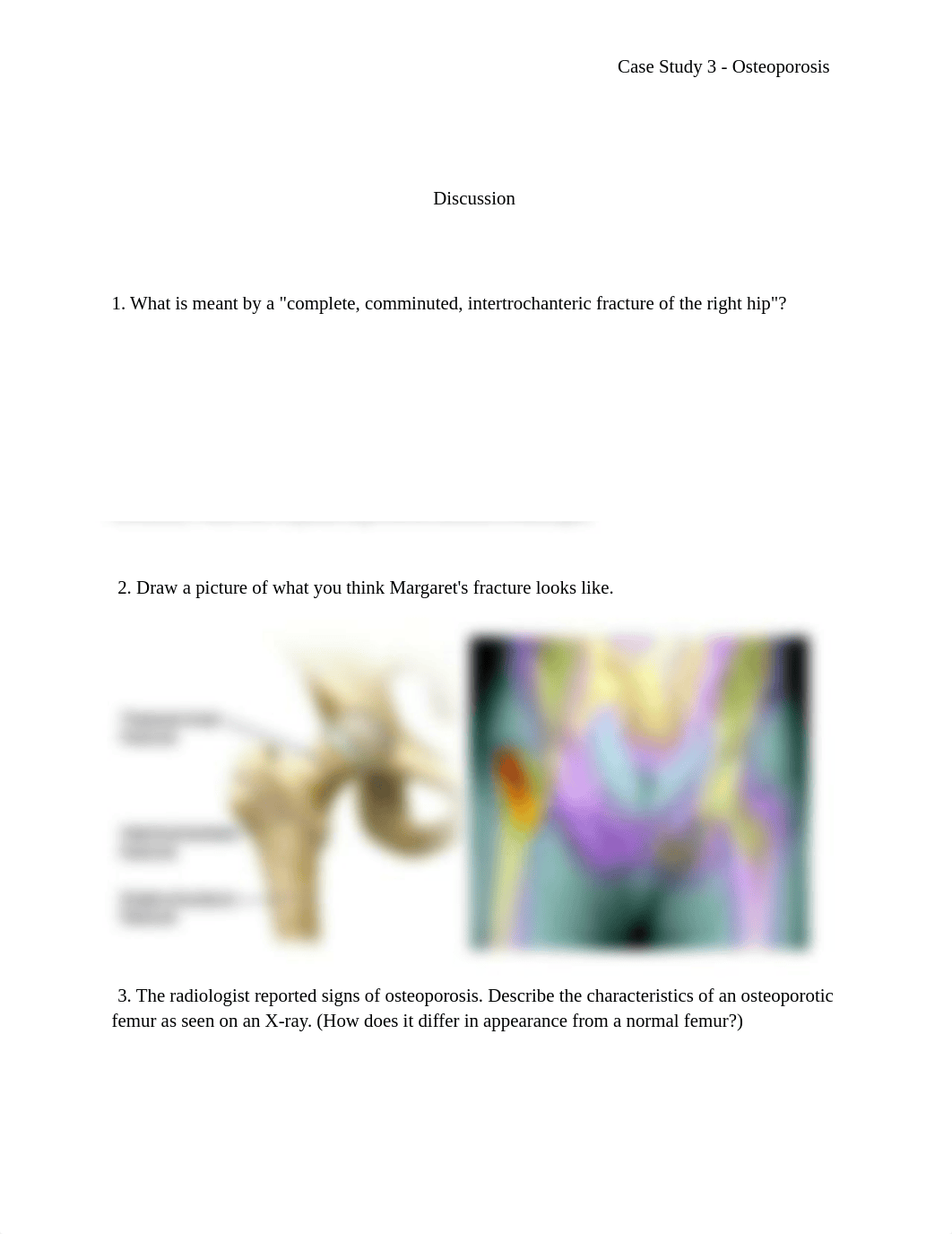 Case Study 3 - Osteoporosis.pdf_dcayf6h2nny_page4