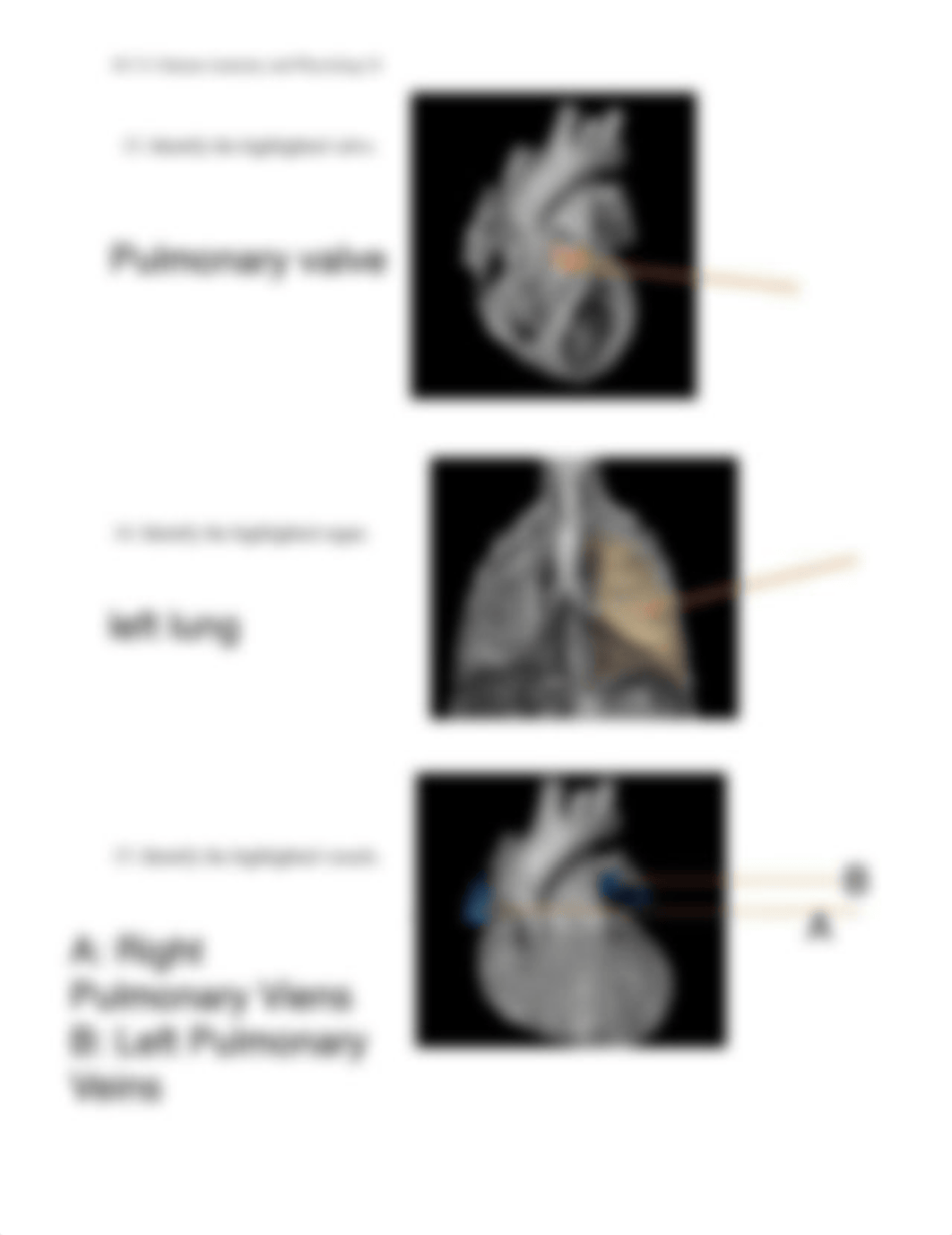 Unit 2 Assignment Real Anatomy WS.pdf_dcbupu3tzlh_page5