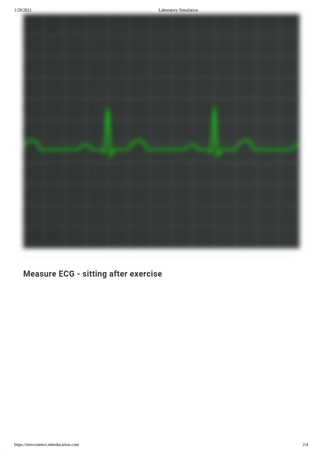 Virtual Lab_ ECG.pdf_dccq765qxf4_page2