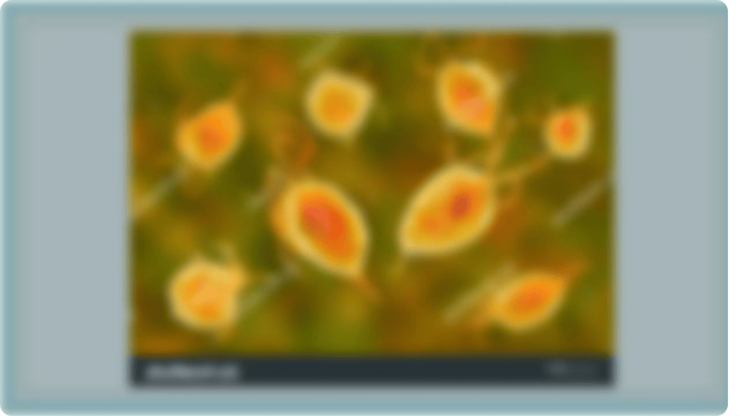 Trichomoniasis.pptx_dccv7dw0jhe_page2