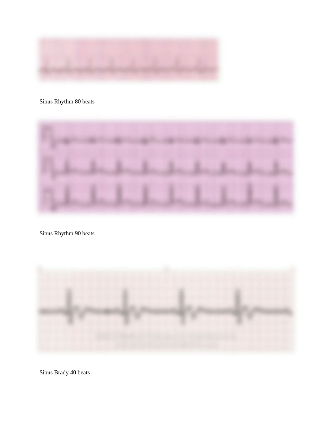 ECG STRIPS SET 2 SKILLS.docx_dcgcewwgbrj_page4