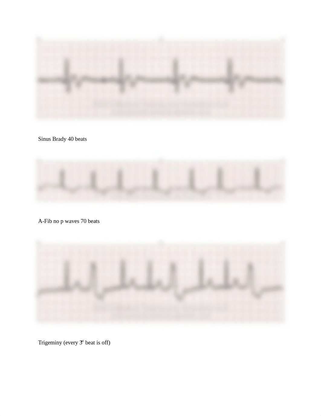 ECG STRIPS SET 2 SKILLS.docx_dcgcewwgbrj_page3