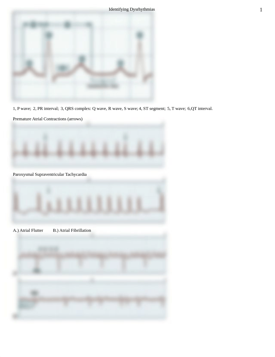 Identifying Dysrhythmias.docx_dch1ktqp7kf_page1