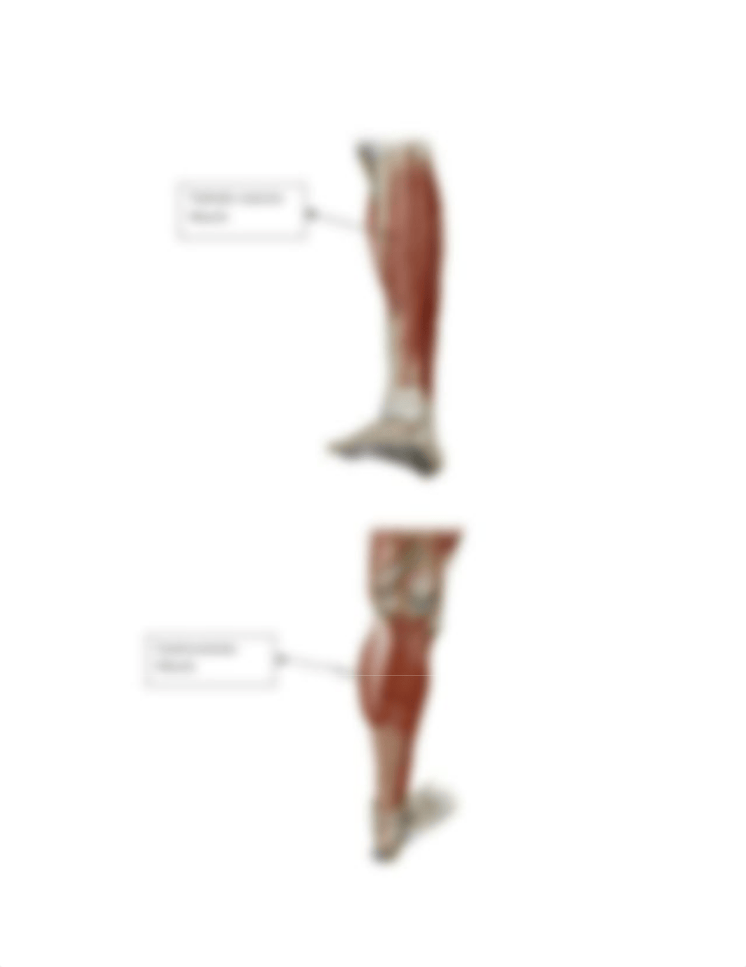 Tremaine Haley- BIO107 Lab Muscles Labeling Worksheet.docx_dci8lwm9shj_page4