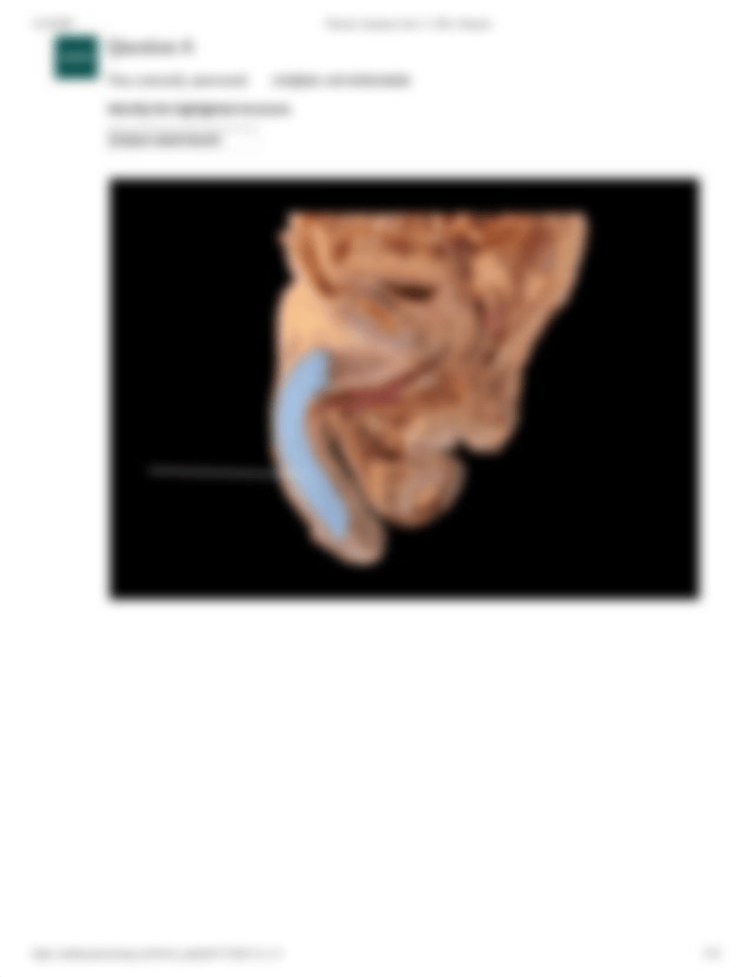 Doris Bowdre Human Cadaver  Reproductive System Lab Practical.pdf_dcidulmp8pl_page5